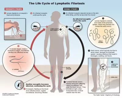 LYMPH NODESL1 LARVAEL3 LARVAEADULTThe Life Cycle of Lymphatic Filarias