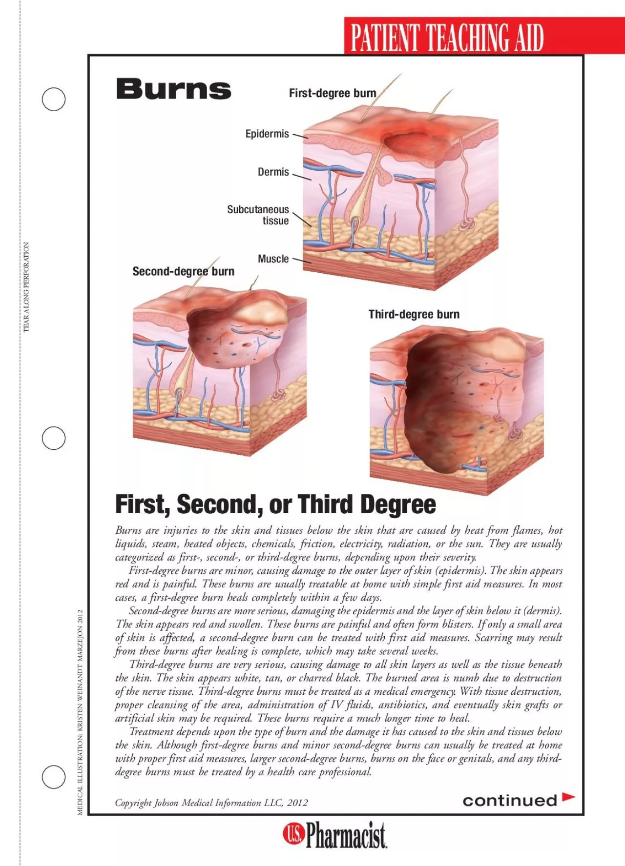 PDF-TEARALONGPERFORATION