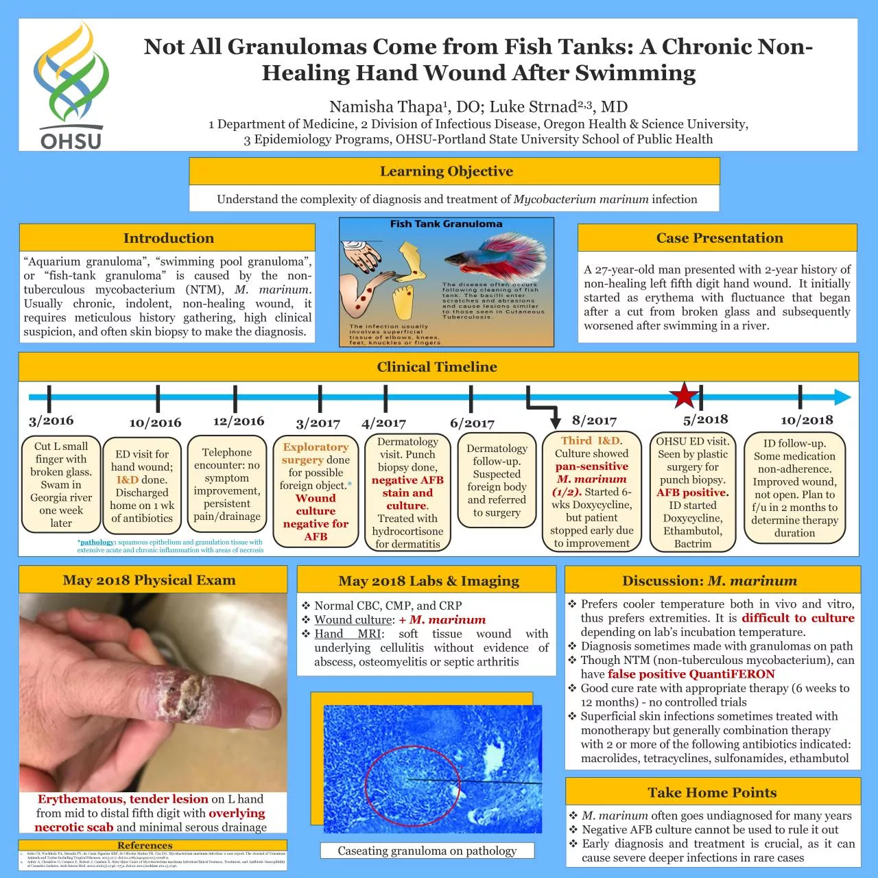 PDF-Not All Granulomas Come from Fish Tanks A Chronic Non