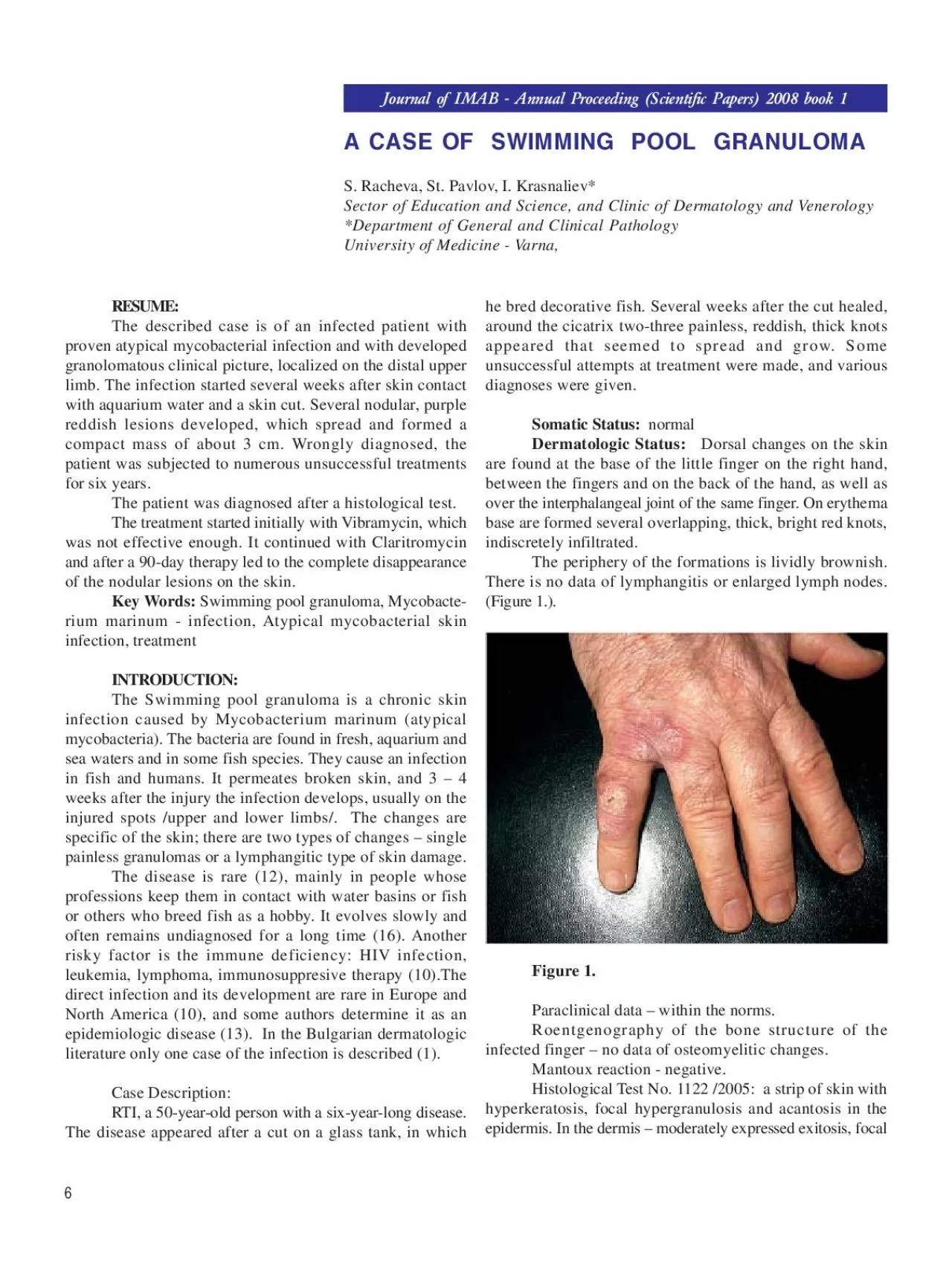 PDF-A CASE OF SWIMMING POOL GRANULOMAS Racheva St Pavlov I Krasnal