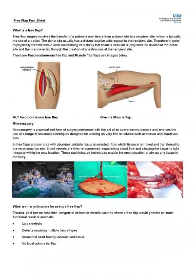 Free Flap Fact Sheet