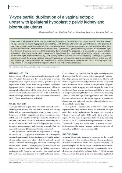 e135Cystourethroscopy revealed that the right hemitrigone was absent a