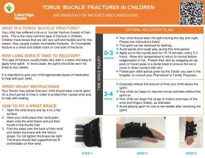 TORUS BUCKLE FRACTURES IN CHILDREN