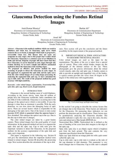 Glaucoma Detection