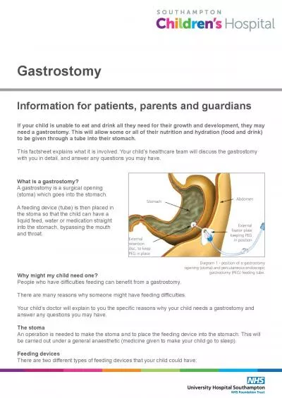 Gastrostomy