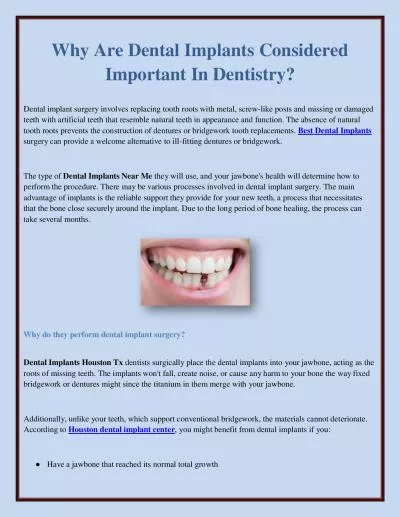 Why Are Dental Implants Considered Important In Dentistry?
