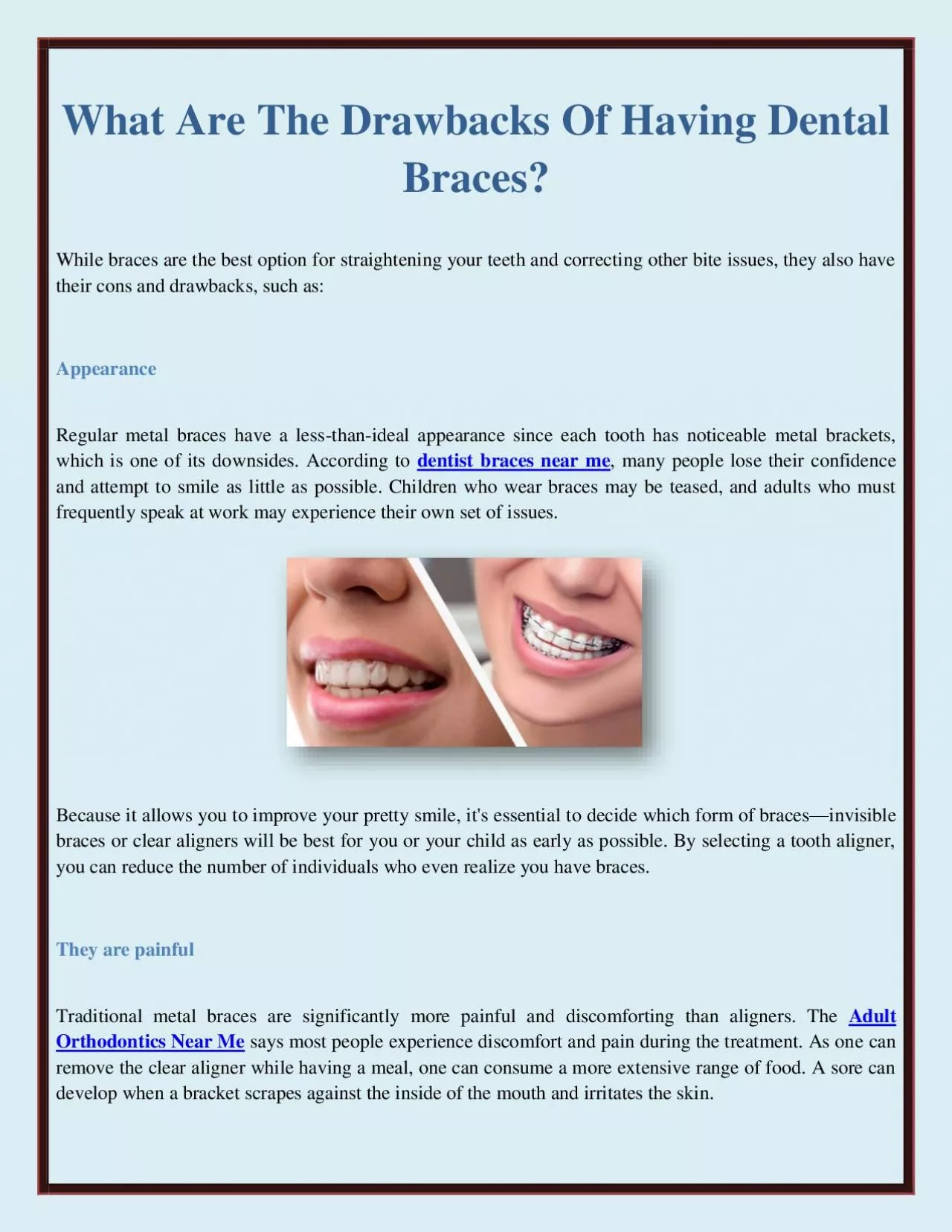 What Are The Drawbacks Of Having Dental Braces?