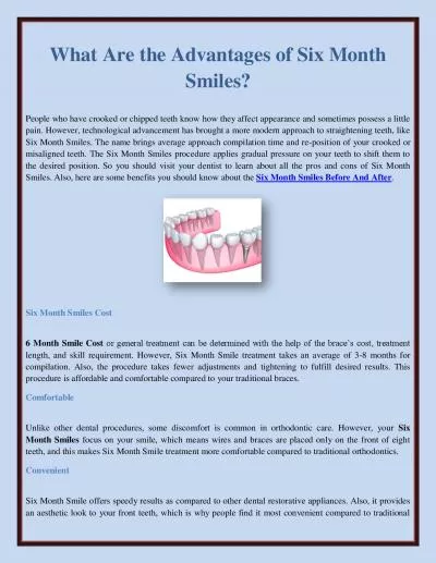 What Are the Advantages of Six Month Smiles?