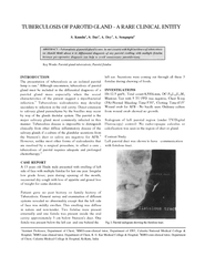 TUBERCULOSIS OF PAROTID GLAND - A RARE CLINICAL ENTITY