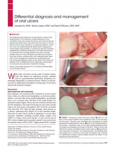 Differential diagnosis and management of oral ulcershile many oral ulc