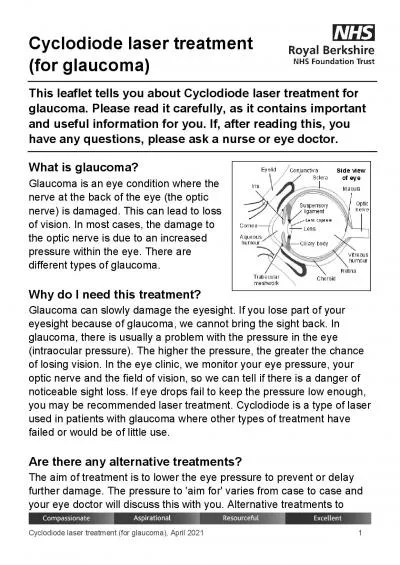 Cyclodiode laser treatment for glaucomaApril2021