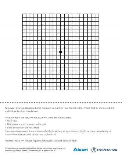 An Amsler Grid is a simple at home test used to monitor your central v