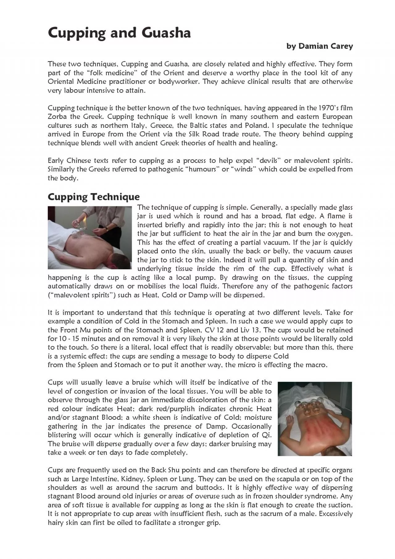 PDF-Cupping and Guasha