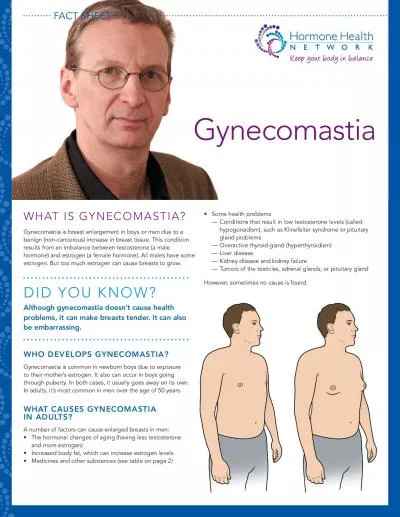 WHAT IS GYNECOMASTIAGynecomastia is breast enlargement in boys or men