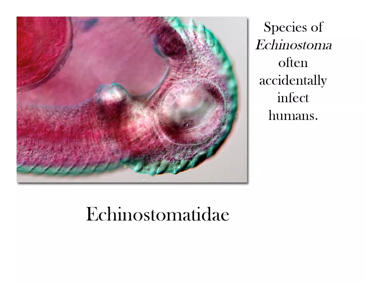 PDF-Metacercariae penetrate gut to peritoneumPenetrate Glissons capsule