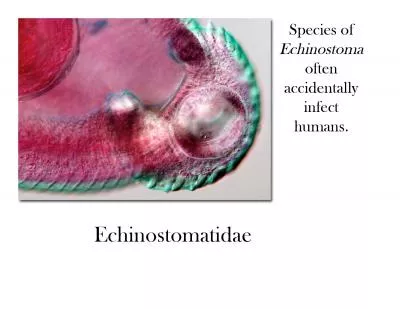 Metacercariae penetrate gut to peritoneumPenetrate Glissons capsule