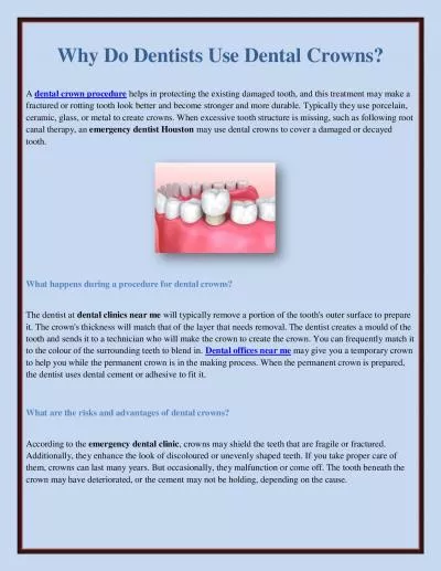 Why Do Dentists Use Dental Crowns?