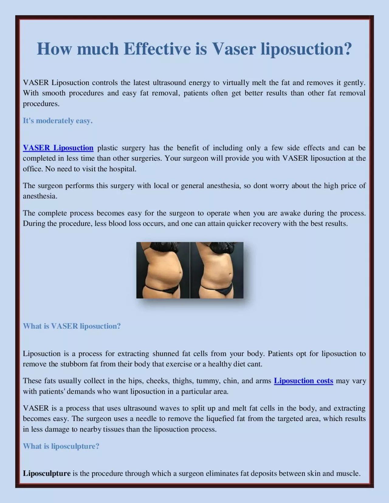 How much Effective is Vaser liposuction?