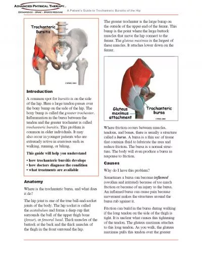 A Patients Huide to Trochanteric Cursitis of the Iip