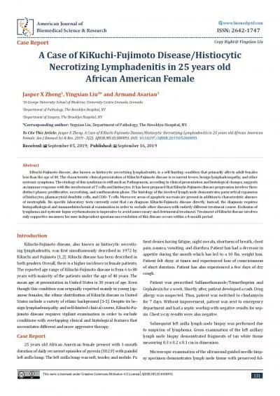 A Case of KiKuchiFujimoto DiseaseHistiocytic