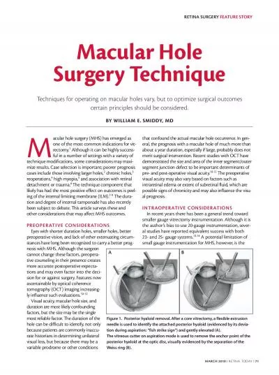 RETINA SURGERY FEATURE STORY