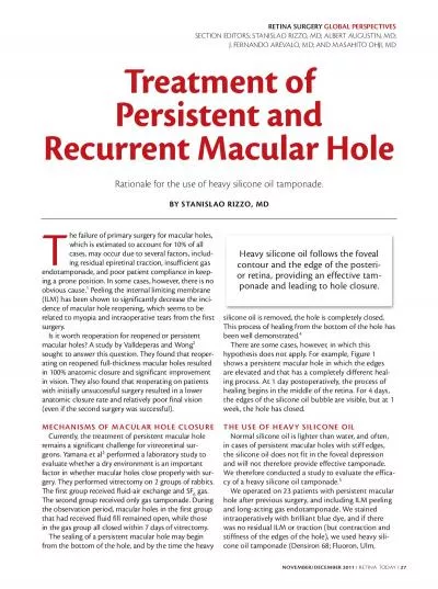 Treatment of Persistent andRecurrent Macular Hole