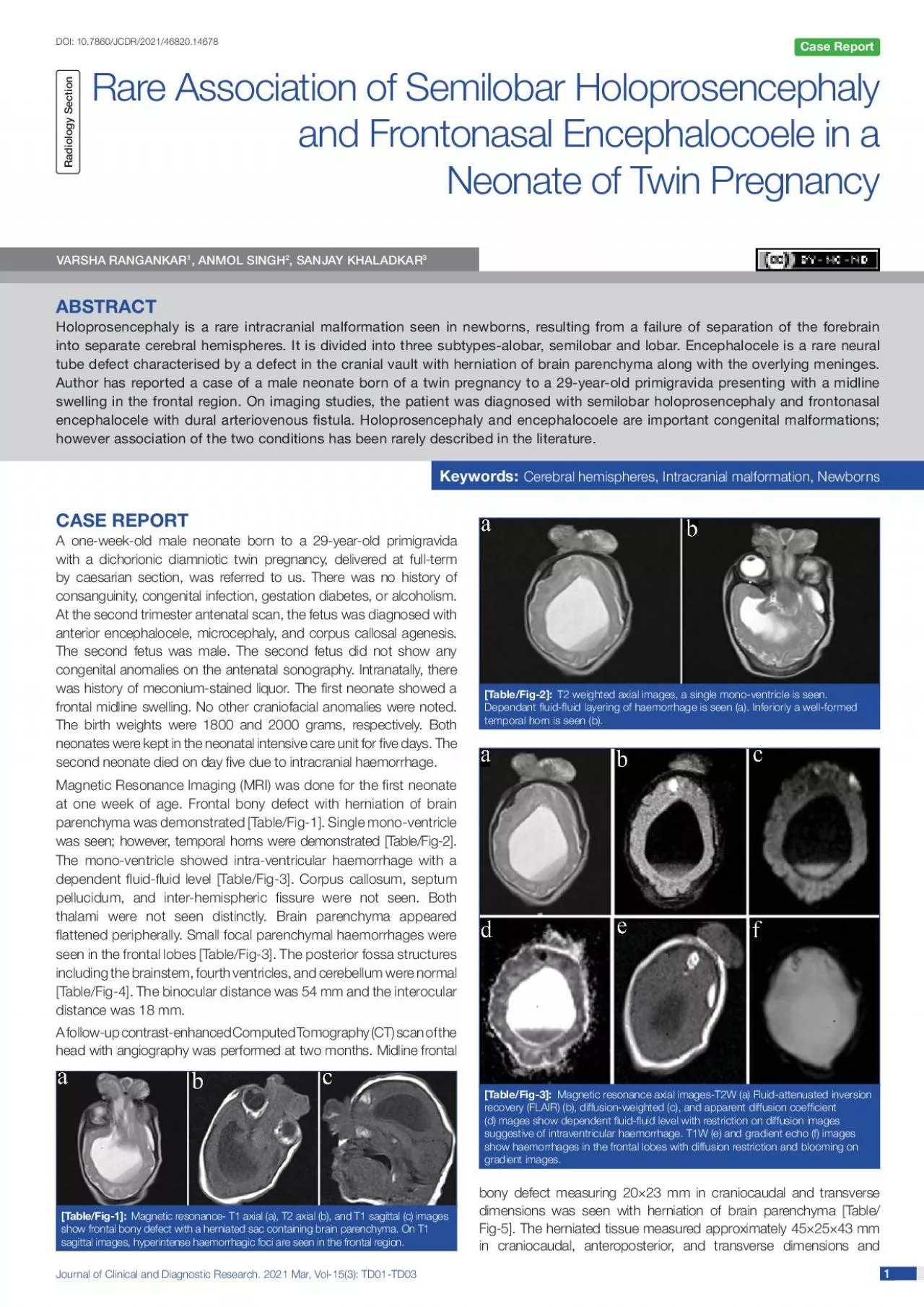 PDF-Journal of Clinical and Diagnostic Research 2021 Mar Vol153 TD01