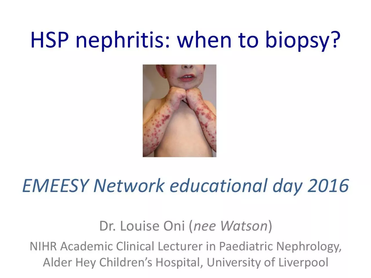 HSP nephritis
