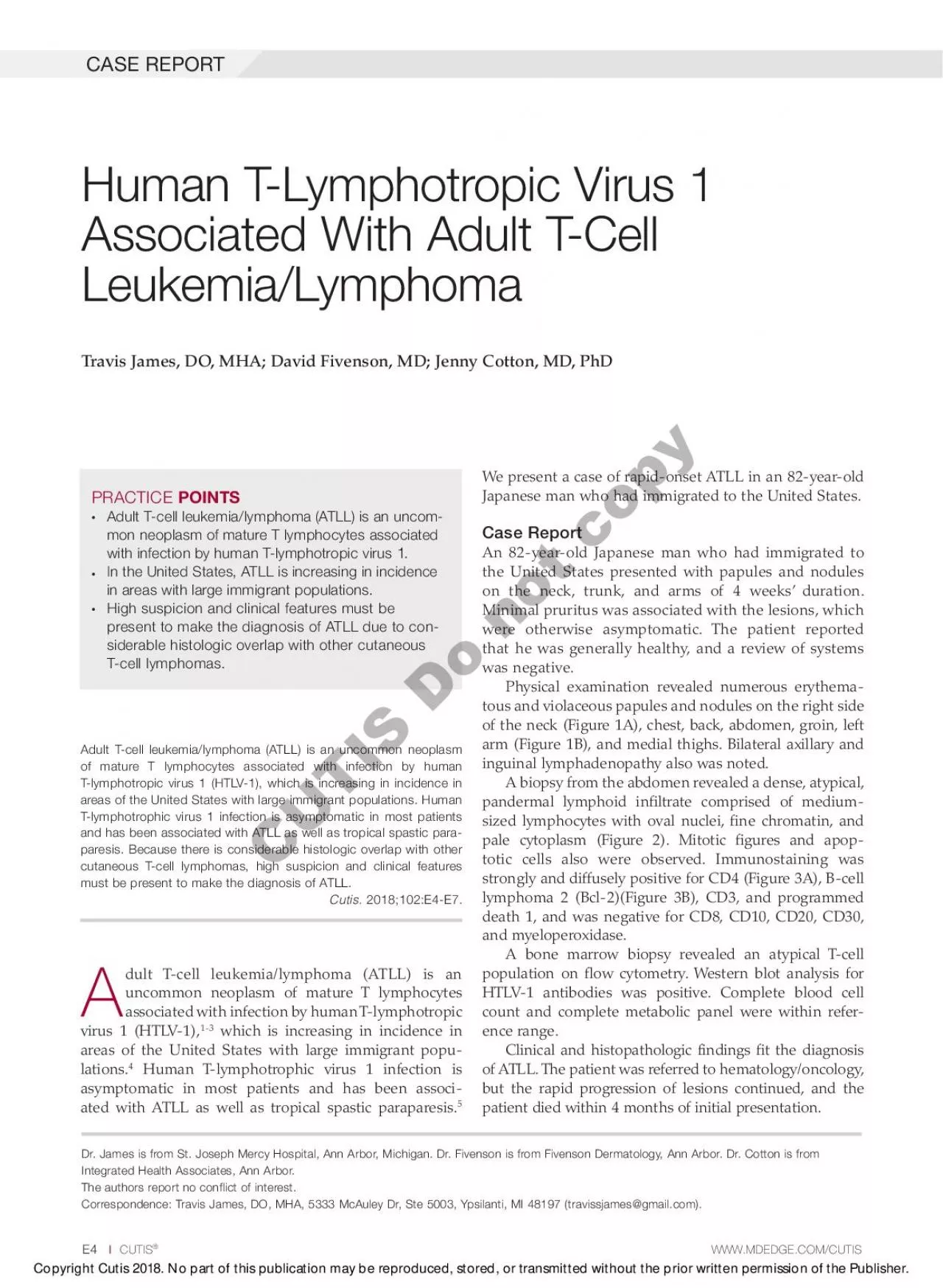 PDF-Adult Tcell leukemialymphoma ATLL is an uncommon neoplasm