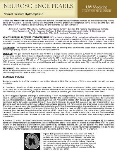 Normal Pressure Hydrocephalus