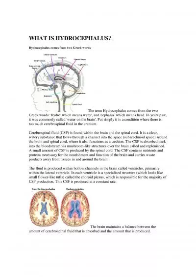 WHAT IS HYDROCEPHALUS Hydrocephalus comes from two Greek words