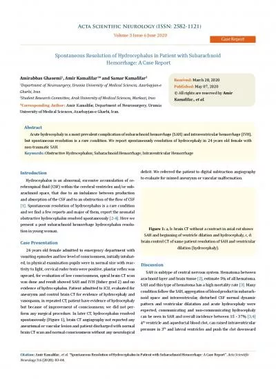 Acta Scientific Neurology ISSN 25821121     Volume 3 Issue 6 June