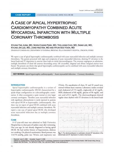 We report a case of apical hypertrophic cardiomyopathy combined with a