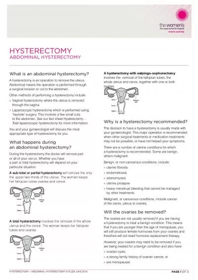 Hysterectomy-abdominal-280519.pdf