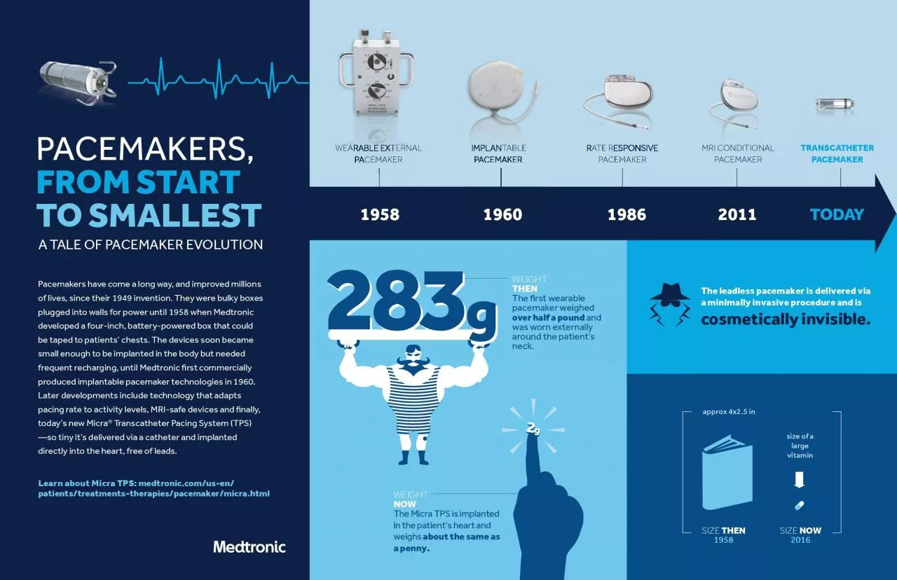 PDF-The leadless pacemaker is delivered viaa minimally invasive procedure