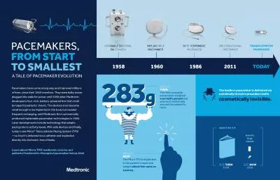 The leadless pacemaker is delivered viaa minimally invasive procedure