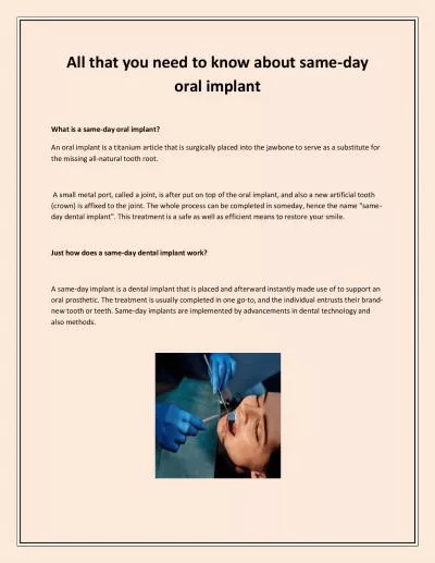 All that you need to know about same-day oral implant