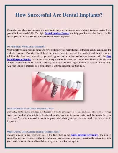 How Successful Are Dental Implants?