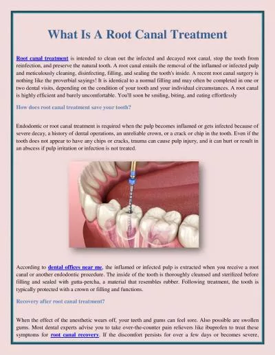 What Is A Root Canal Treatment