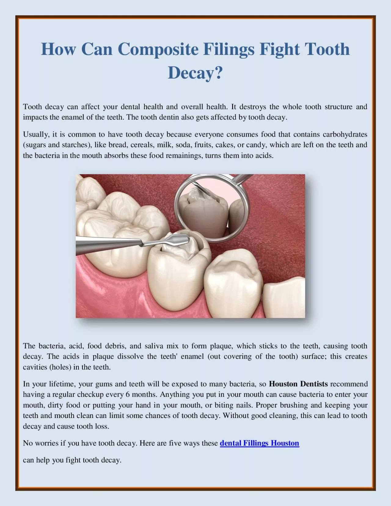 PDF-How Can Composite Filings Fight Tooth Decay?