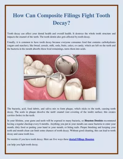 How Can Composite Filings Fight Tooth Decay?
