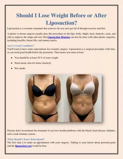Should I Lose Weight Before or After Liposuction?