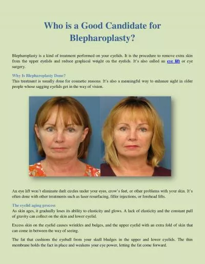 Who Is A Good Candidate For Blepharoplasty?