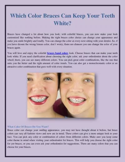 Which Color Braces Can Keep Your Teeth White?