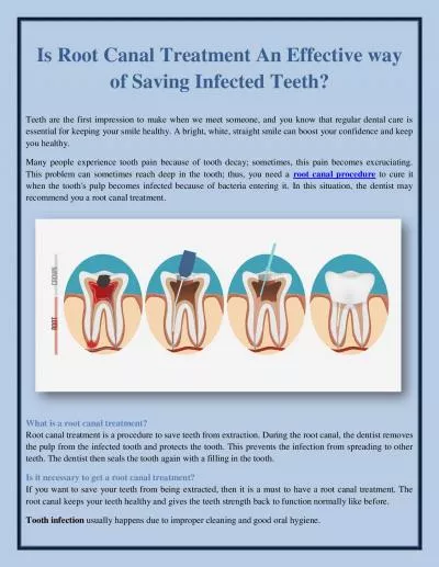 Is Root Canal Treatment An Effective way of Saving Infected Teeth?