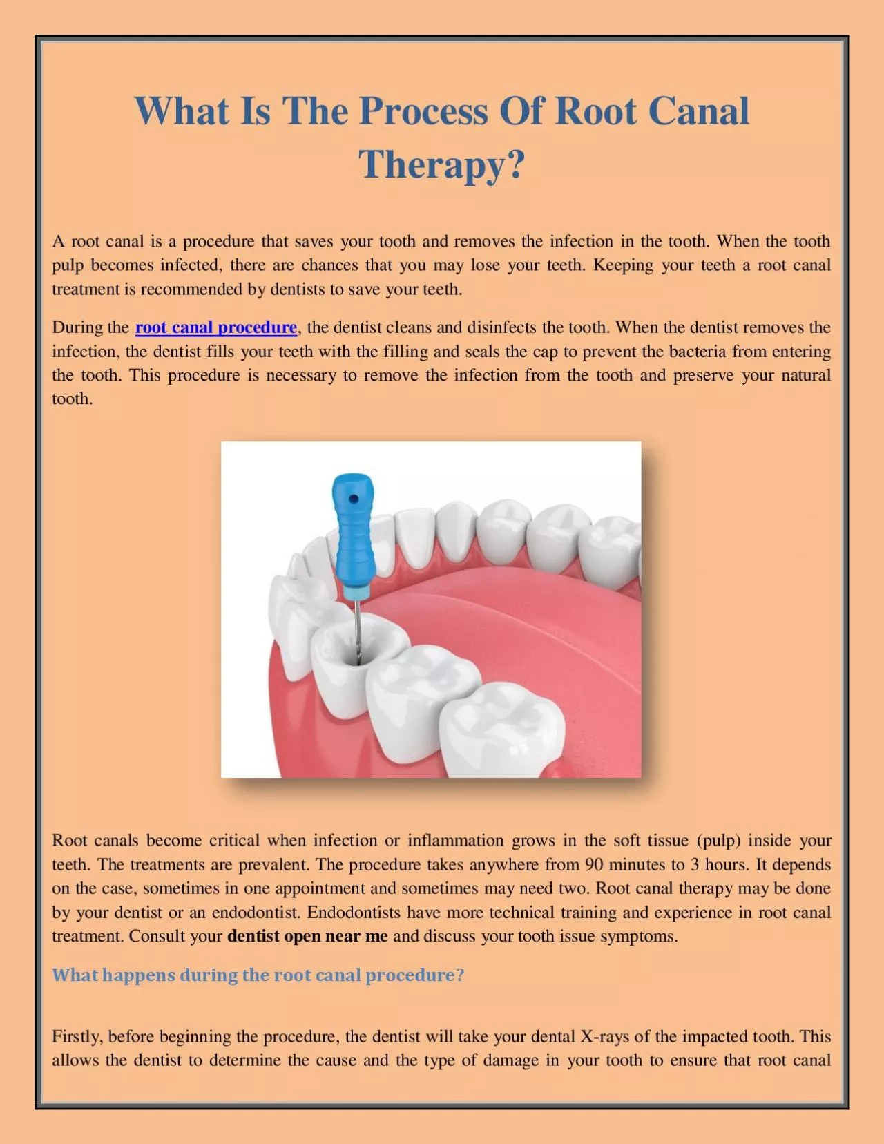What Is The Process Of Root Canal Therapy?