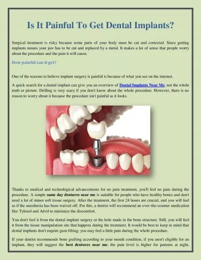 Is It Painful To Get Dental Implants?