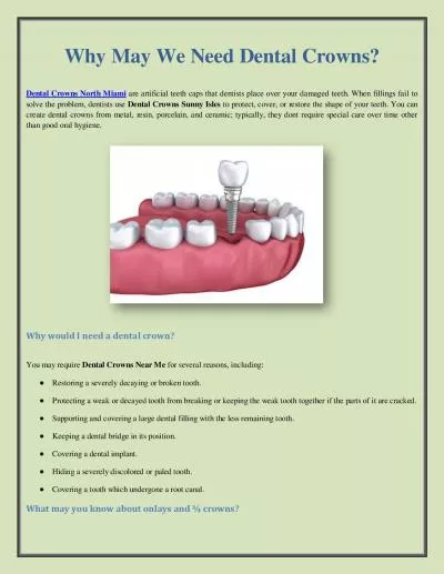 Why May We Need Dental Crowns?