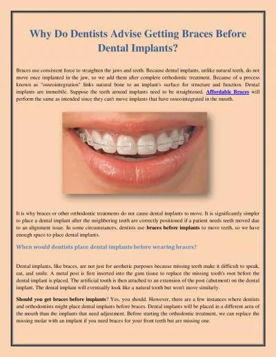 Why Do Dentists Advise Getting Braces Before Dental Implants?