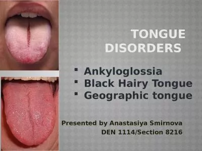 TONGUE DISORDERS   Presented by